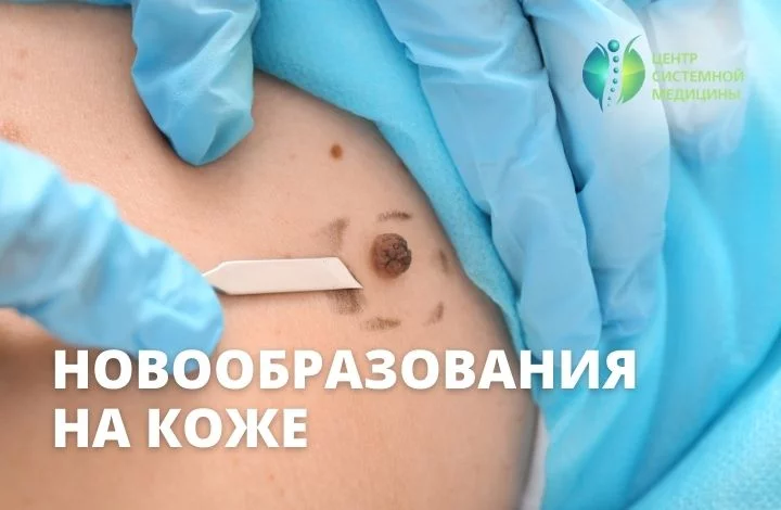 Электрокоагуляция в Центре системной медицины на Новой Риге в день обращения