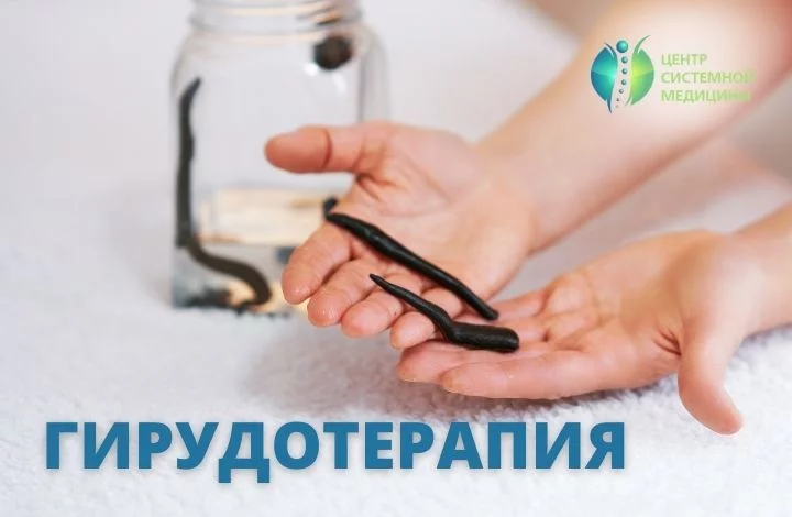 Гирудотерапия в Центре системной медицины на Новой Риге - эффективный метод реабилитации и комплексного лечения